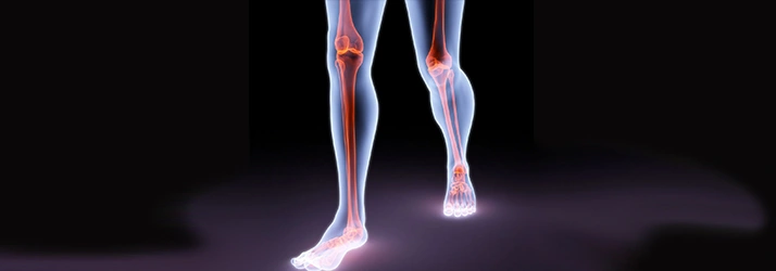 Medical illustration highlighting bones and joints of the lower legs, emphasizing movement, alignment, and pain areas.