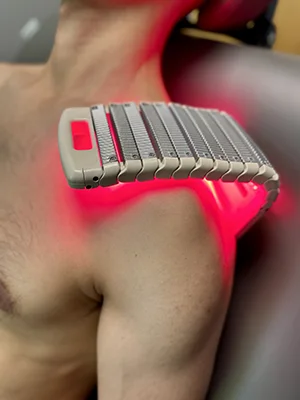 cold laser therapy treatment for pain management